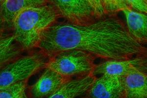 cancer cells